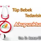 Tüp bebek tedavisinde akupunktur