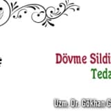 Dövme sildirme tedavisi