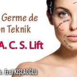 Yüz Germe de Son Teknik M. A. C. S. Lift 