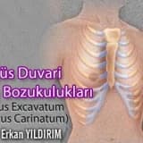 Göğüs duvarı yapı bozuklukları (pectus excavatum - pectus carinatum)