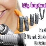 Diş implantları hakkında merak ettikleriniz!