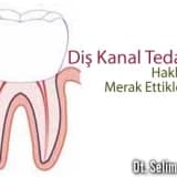 Diş kanal tedavisi hakkında merak ettikleriniz