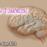 Beyin Tümörleri