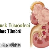 Böbrek Tümörleri - Wilms Tümörü ( Nefroblastom )