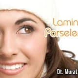 Laminate Porselenler