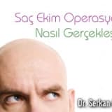 Saç Ekim Operasyonu Nasıl Gerçekleşir ?