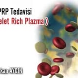 Saç PRP Tedavisi (PLATELET RİCH PLAZMA)