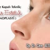 Açık ve Kapalı Teknik; Burun Estetiği ( RİNOPLASTİ )