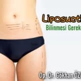 Liposuction hakkında bilinmesi gerekenler