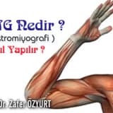 Elektromiyografi (emg) » emg nedir ? nasıl yapılır ?