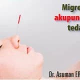 Migrende akupunktur tedavisi