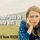 Endometriozis ve cikolata kisti!