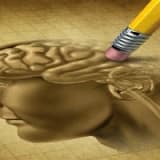 UNUTKANLIK NEDENLERİ