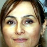 Op. Dr. Aysun  Baltacı Profil Fotoğrafı