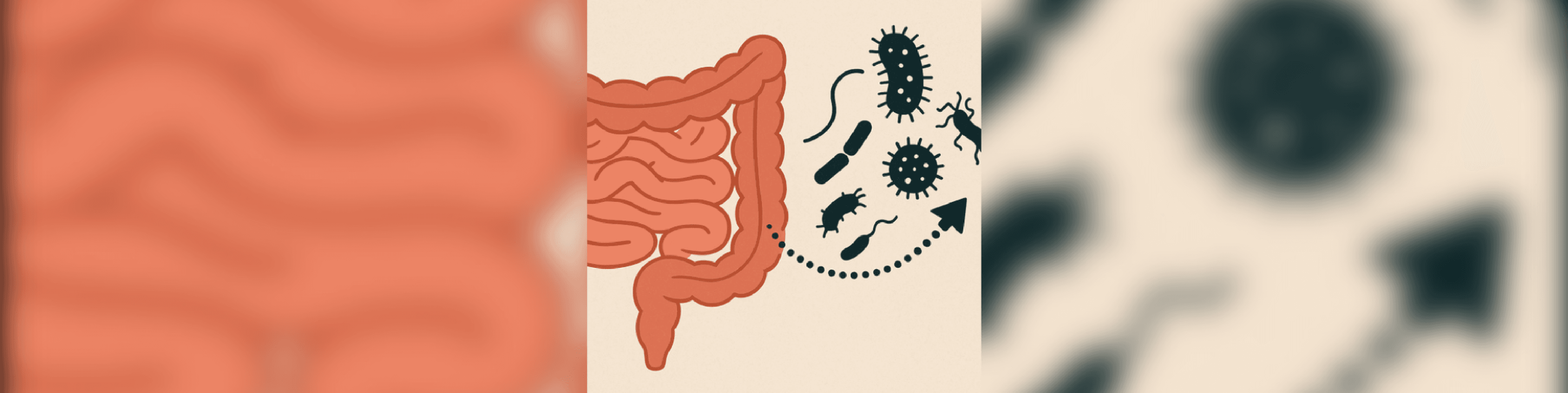 Bağırsak Geçirgenliği (Leaky Gut) Nedir? Belirtileri, Nedenleri ve Çözüm Yolları
