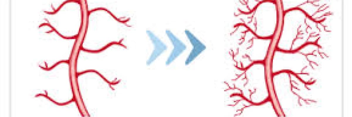 Ed 1000 şok dalga tedavisi