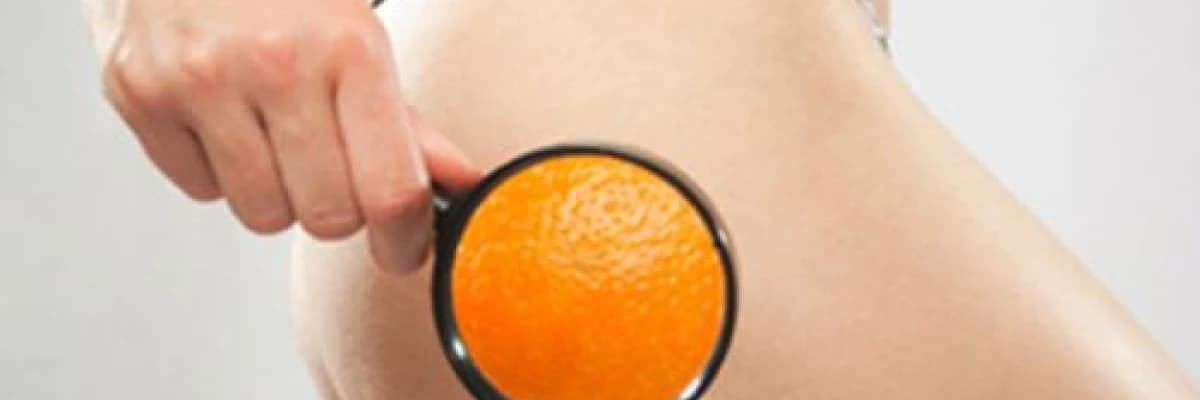 Selülit oluşumunu önlemek için önerilenler