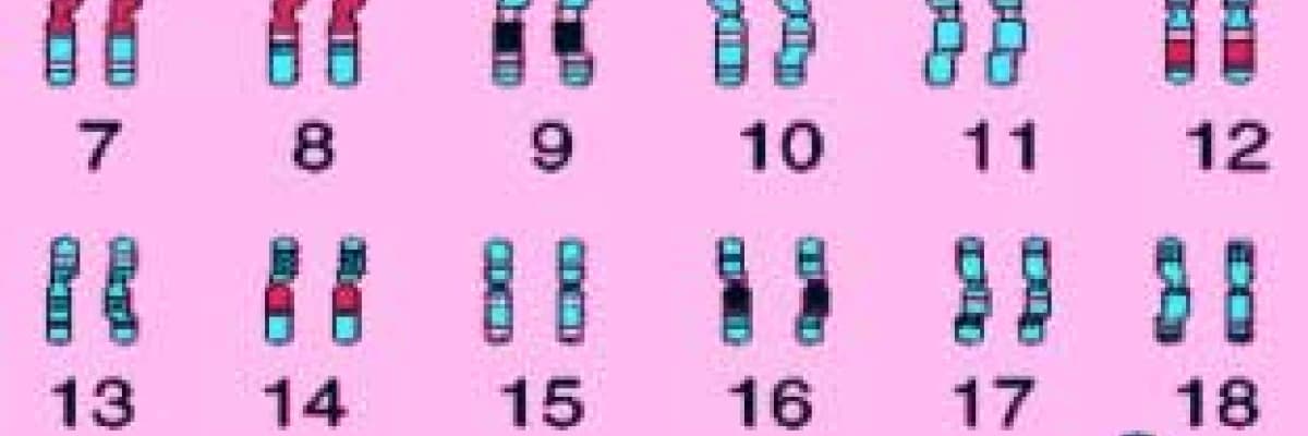 Tek gen hastalıkları ve akraba evlilikleri