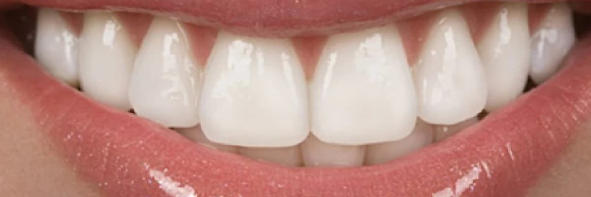 Zirkonyum porselenler