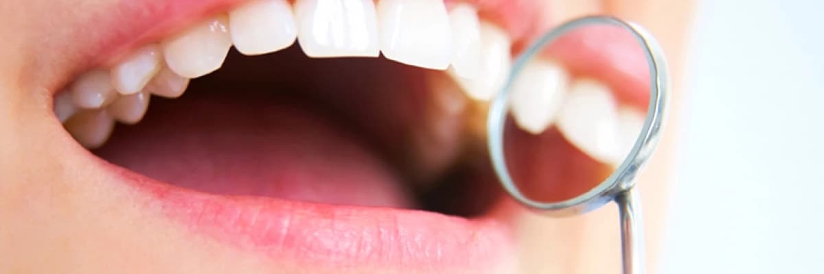 Digital gülüş tasarımı