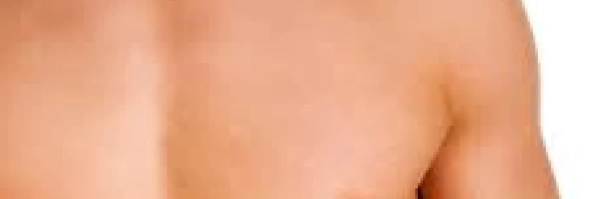 Jinekomasti (erkeklerde meme estetiği)