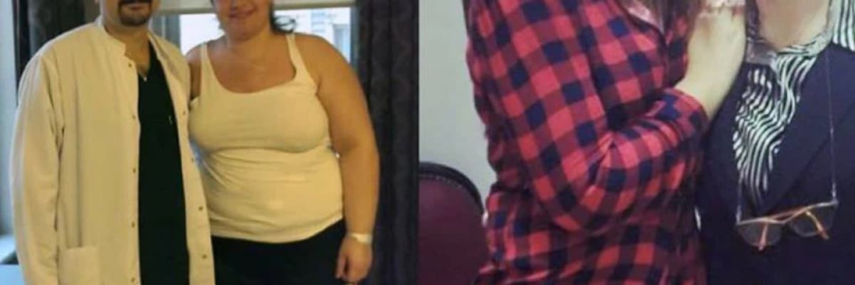 Obezite Cerrahi Sonrası Uyulması Gereken Öneriler