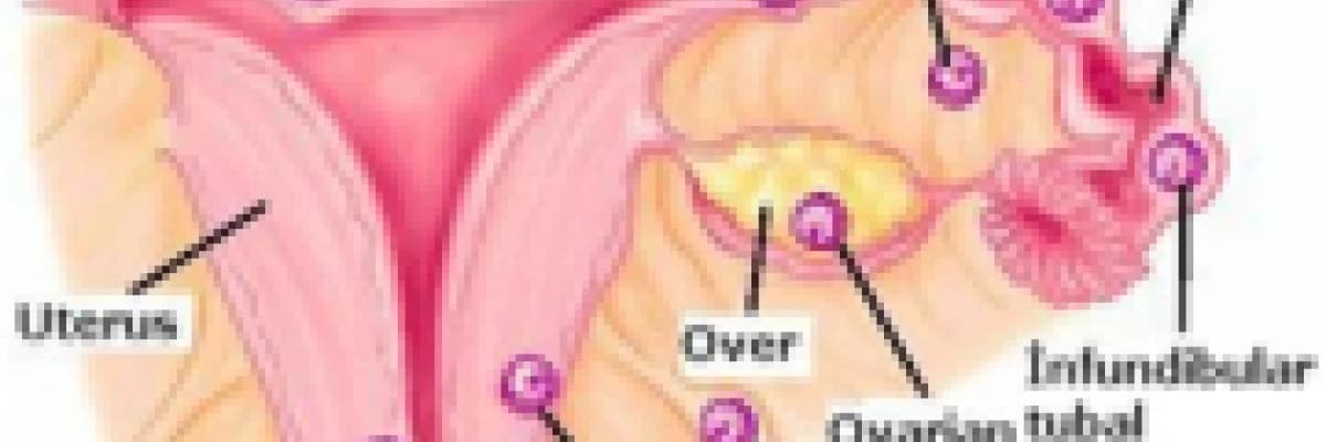 Rahim Sarkması Hakkında