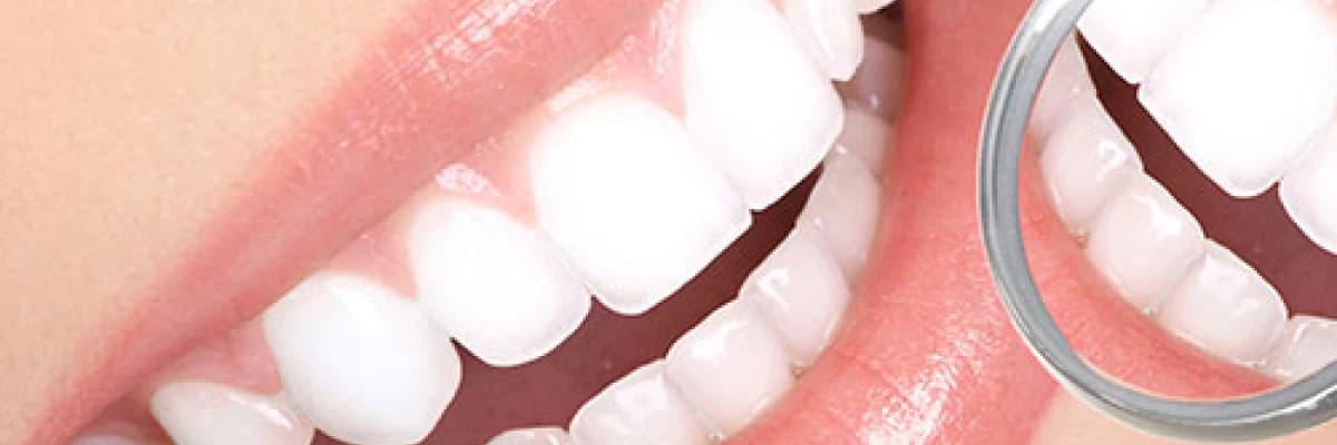 Estetik diş hekimliği uygulamaları