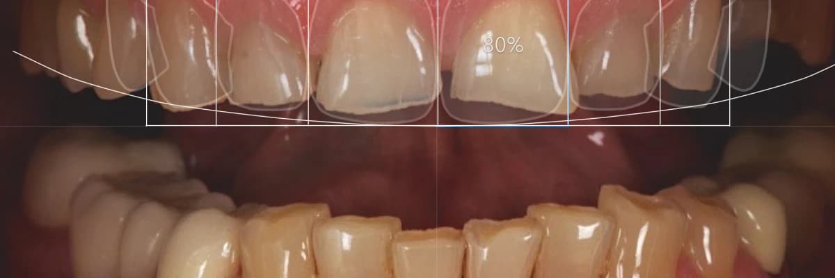 GÜLÜŞ TASARIMI NEDİR?