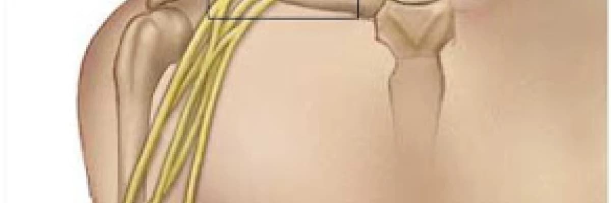 BRAKİAL PLEKSUS YARALANMALARINDA TEDAVİ YAKLAŞIMLARIM