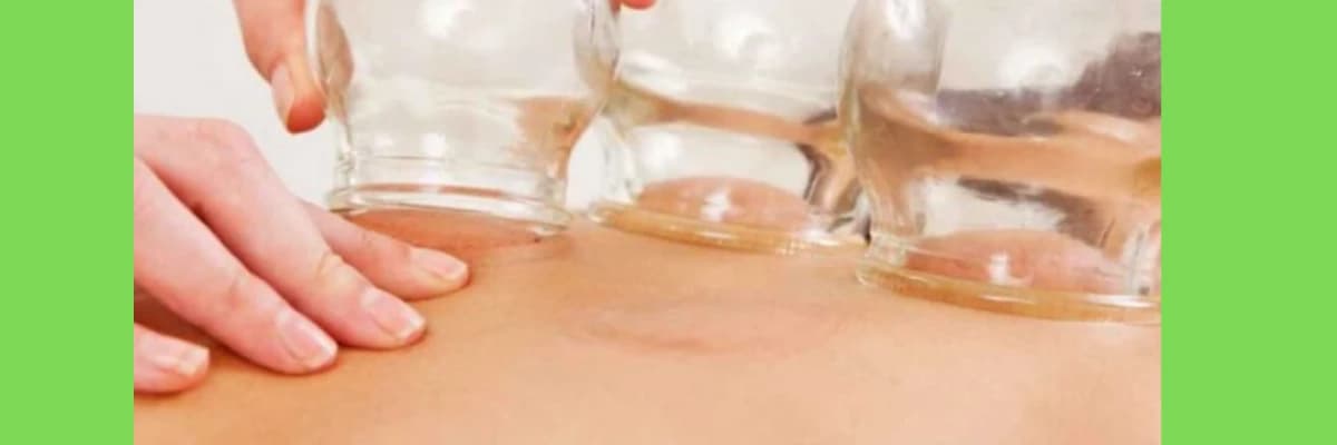 HACAMAT ÖNCESİ ve SONRASI DİKKAT EDİLMESİ GEREKEN HUSUSLAR