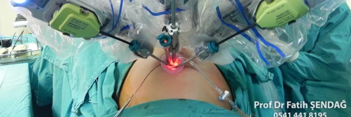 Laparoskopi ve Robotik Cerrahi Arasındaki Farklar