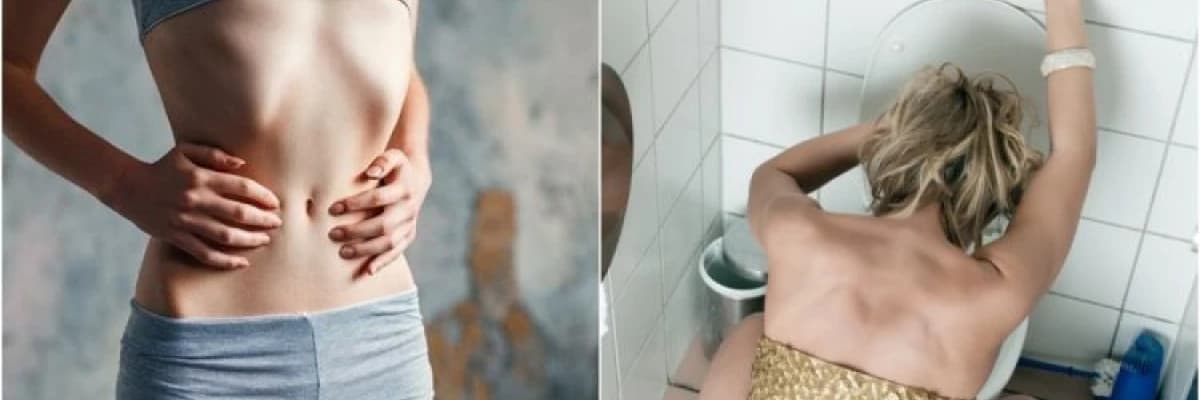 Bulimia Nervoza Neden Olur?
