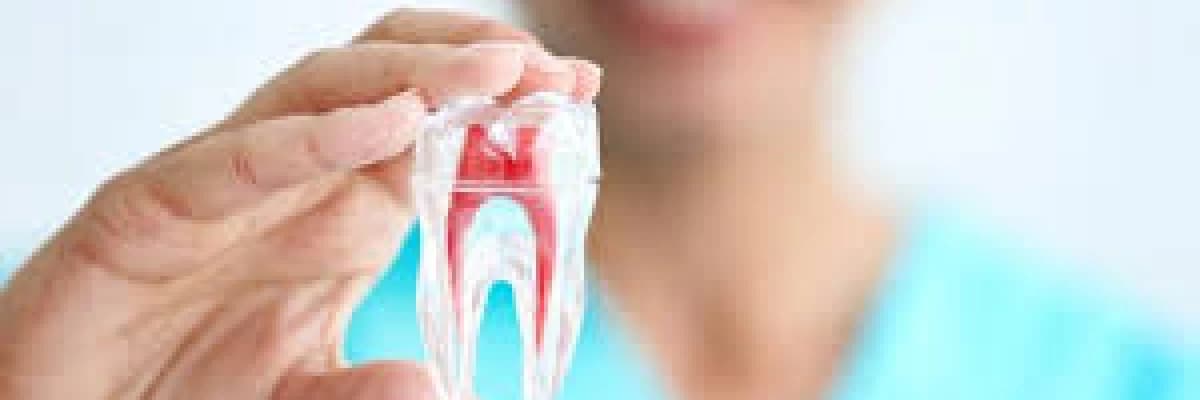 Diş Çürüğü Neden Olur, Nasıl Tedavi Edilir?