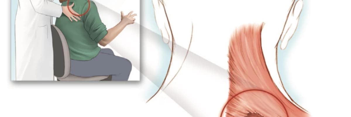 Boyun kaslarında Fibromyalji