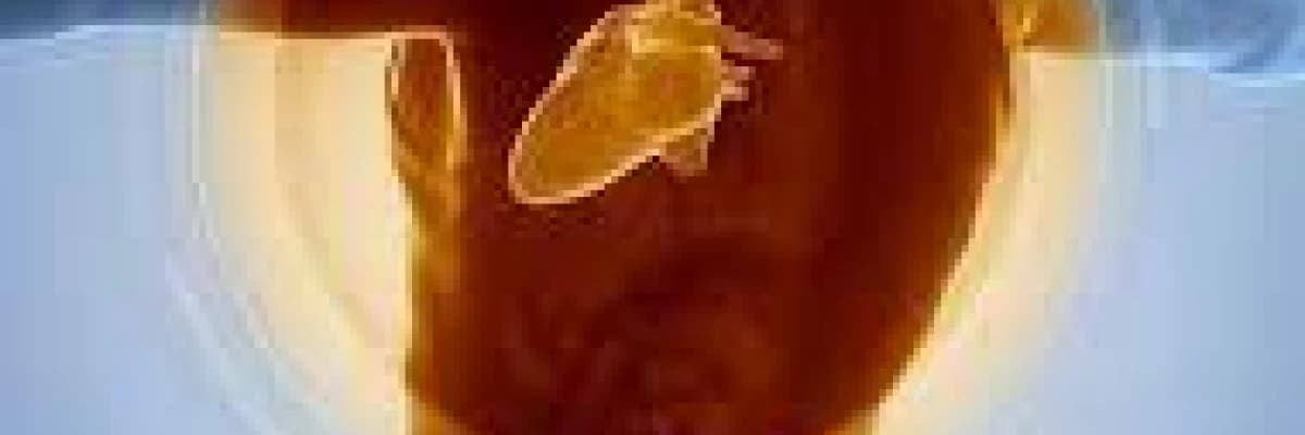 Somatizasyon ve Ağrı Bozukluğu