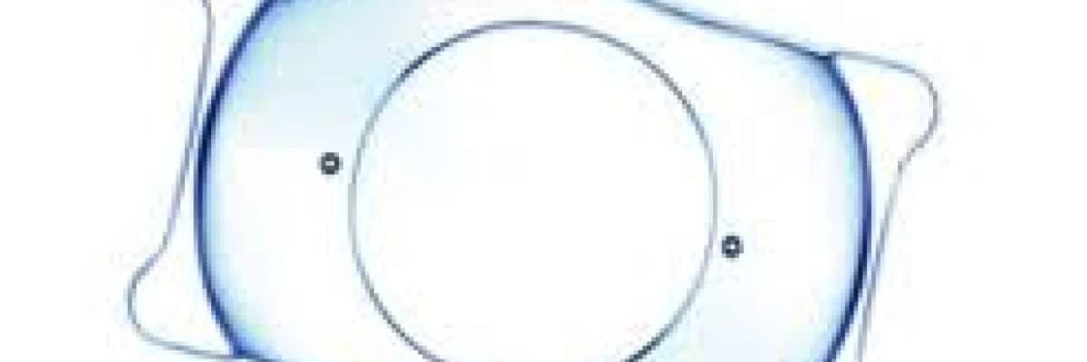 Çok yüksek miyop ve astigmatta uygun çözüm: Fakik göz içi lensleri