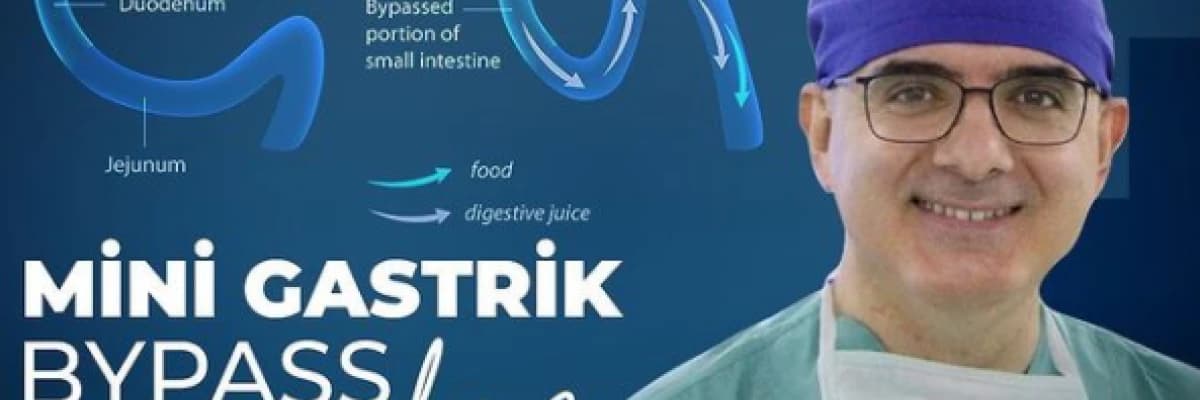 Mini Gastrik Bypass Nedir?