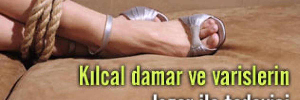 Kılcal damar ve varislerin lazer ile tedavisi