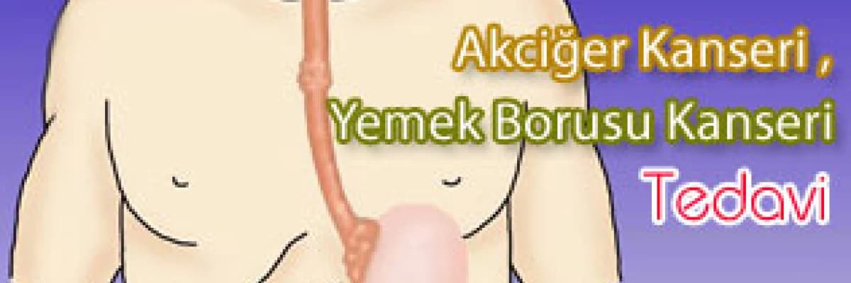 Akciğer kanseri, yemek borusu kanseri , tedavi