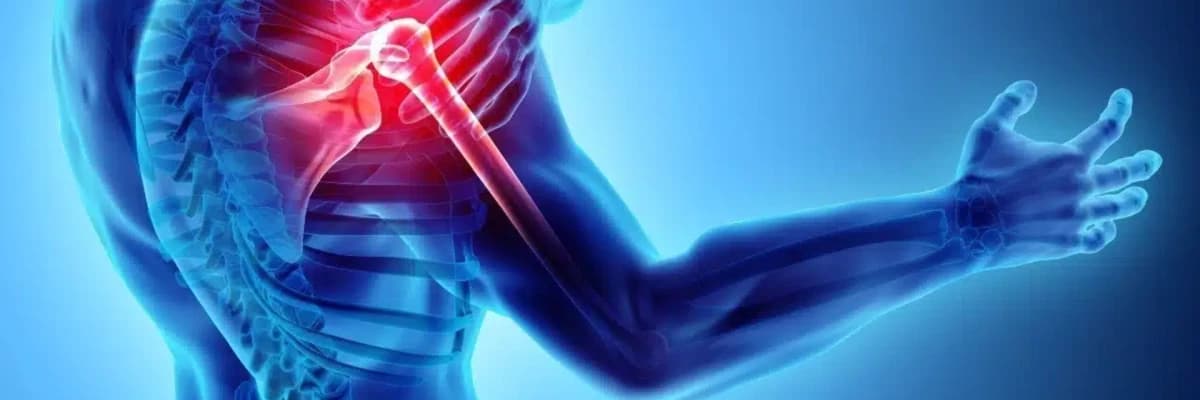 Donuk Omuz-Donmuş Omuz, Gerçekten de Donmuş mu?