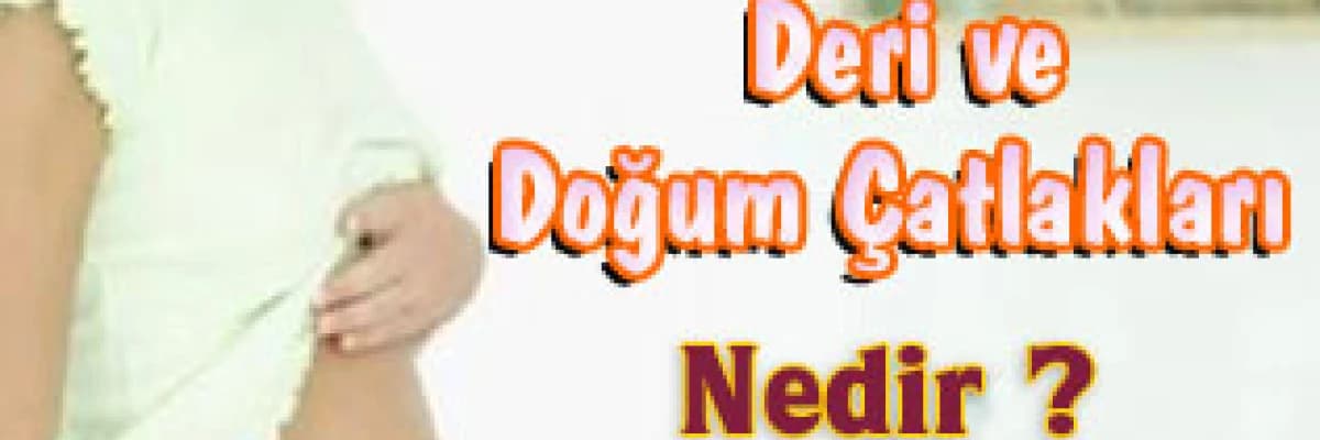 Deri ve doğum çatlakları nedir ?