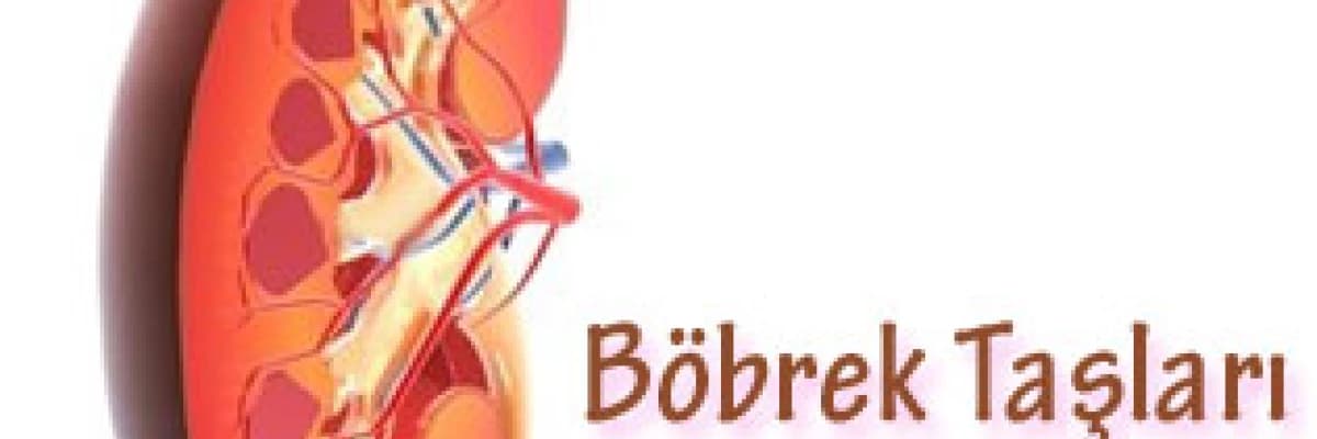 Böbrek taşları, belirtileri ve tedavisi