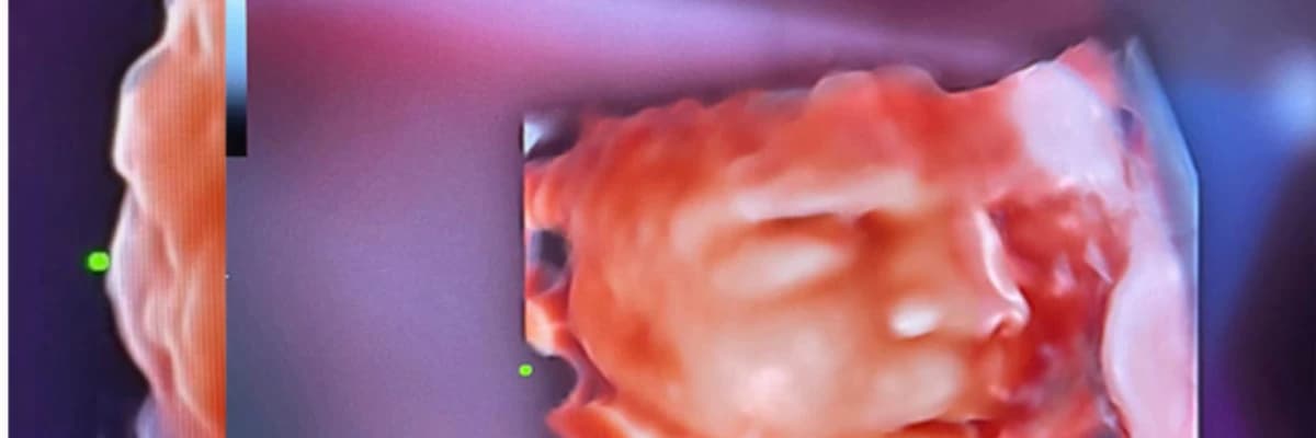 4 Boyutlu Ayrıntılı Ultrason