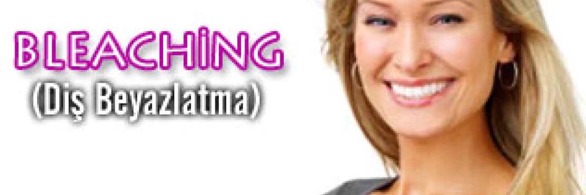 Bleaching (diş beyazlatma) beyaz dişler mutlu gülüşler