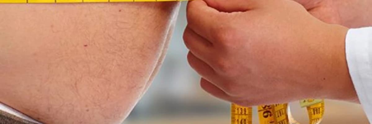 Tüp Mide (Sleeve Gastrektomi)