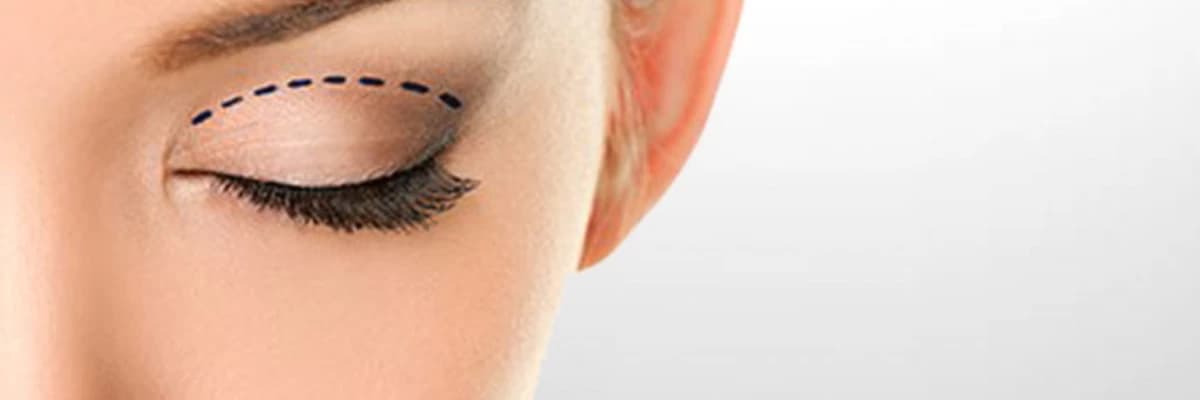 Göz Kapağı Estetiği