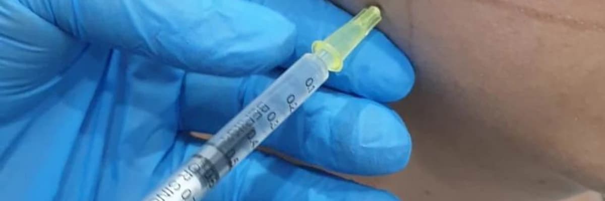 Bruksizm (Diş Sıkma) Nedir? Bruksizm Belirtileri ve Tedavisi