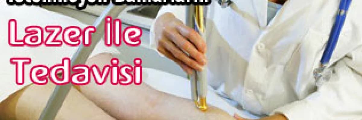 Ayaktaki istenmeyen damarların lazer ile tedavisi