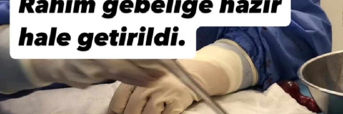 Bursa'da Tam 21 Adet Miyom Çekirdeği RAHİM KORUNARAK Çıkartıldı.